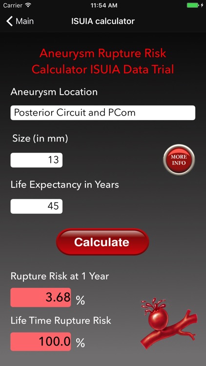 Aneurysm Rupture Risk Calculator