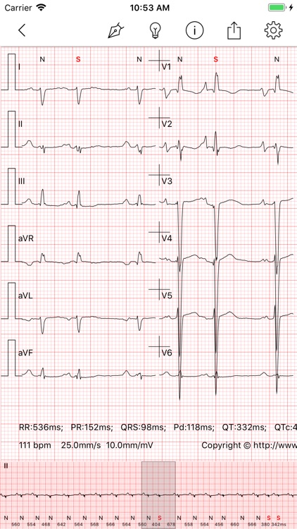 ECG - Cases for CME & EMT