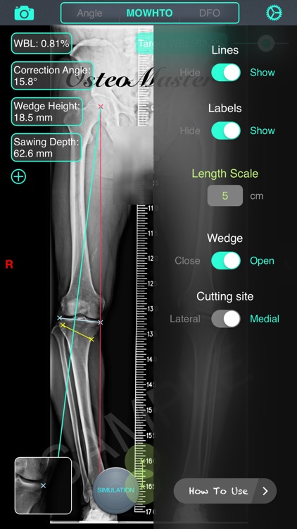 OsteoMaster screenshot-3