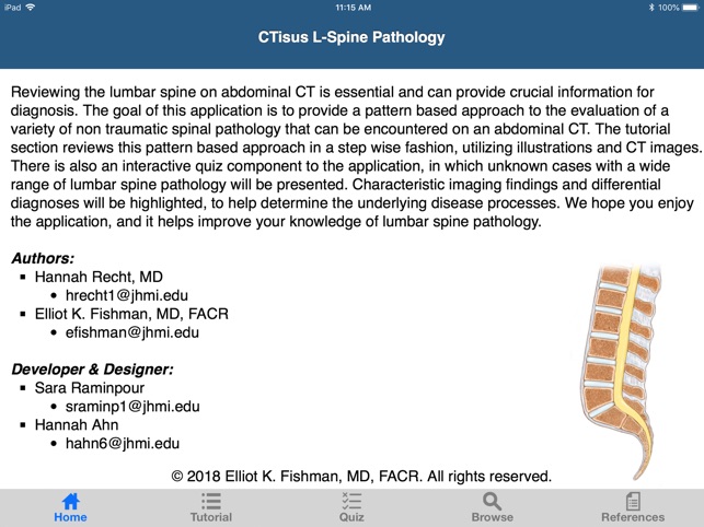 CTisus L-Spine Pathology