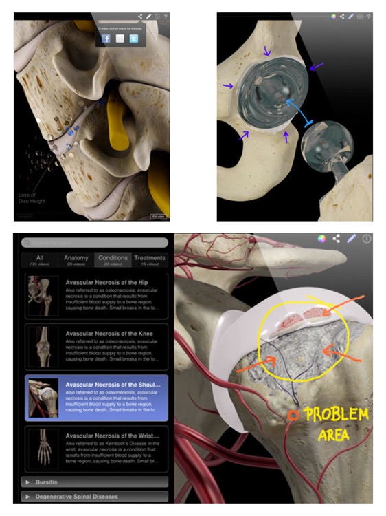 Orthopedic Patient Education screenshot-3