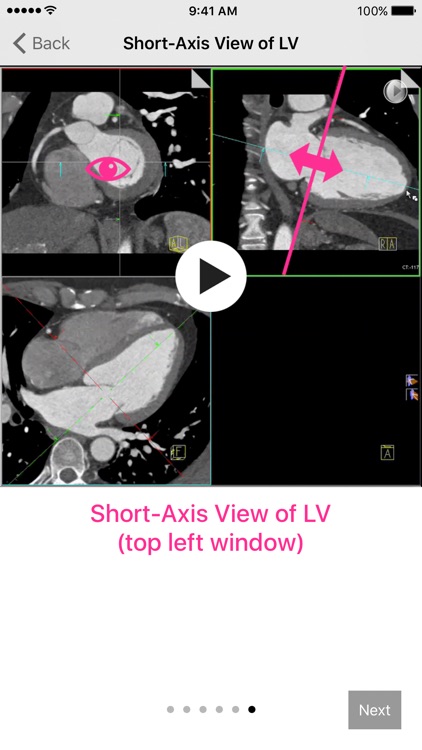 Cardiac Imaging Planes 1-2-3 screenshot-3