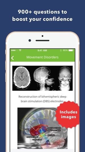 Neurology Exam Review Q&A(圖2)-速報App