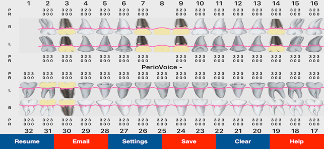 Voice Activated Periodontal Charting