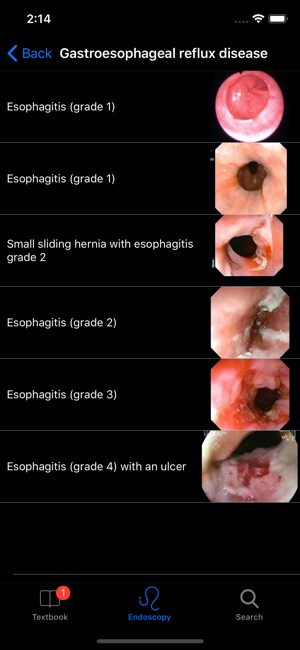 ENDO3® Gastrointestinal Atlas(圖2)-速報App