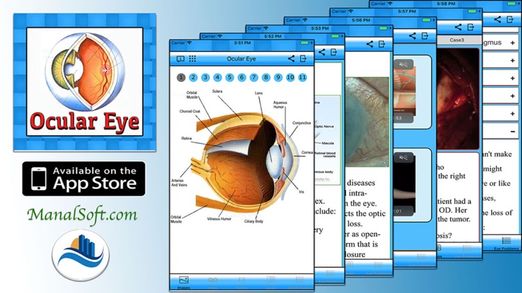 Ocular Eye