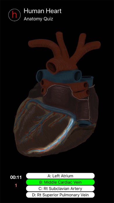 Human Heart Anatomy Quiz screenshot 4