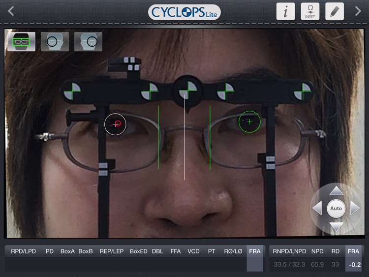 Cyclops Lite screenshot-3
