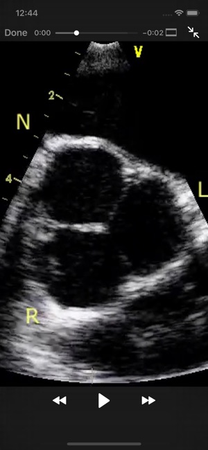 CARDIO3®Echocardiography(圖4)-速報App