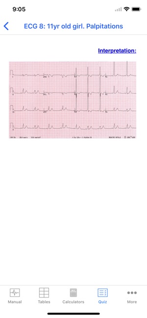 Rapid Paed ECG(圖5)-速報App