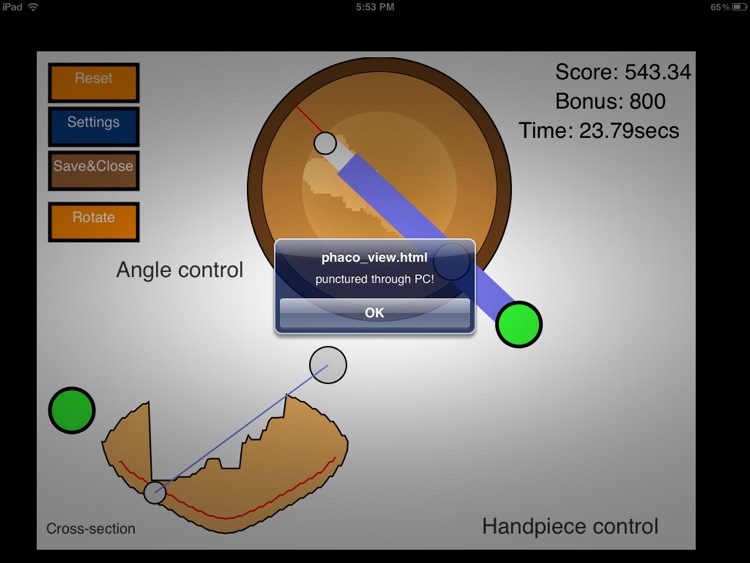 cataractSurgery screenshot-3