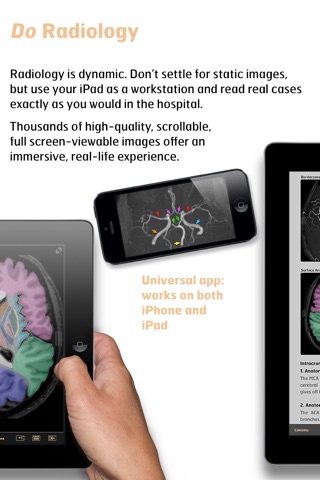 Radiology - Imaging in Stroke screenshot 3