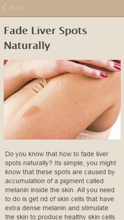 How To Remove Liver Spots