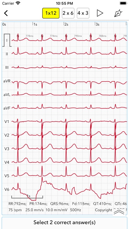 ECG Test Pro for Doctors screenshot-8