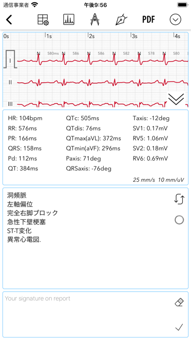 ECG Pro for Doctors screenshot1