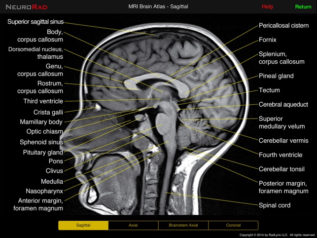 NeuroRad(圖1)-速報App