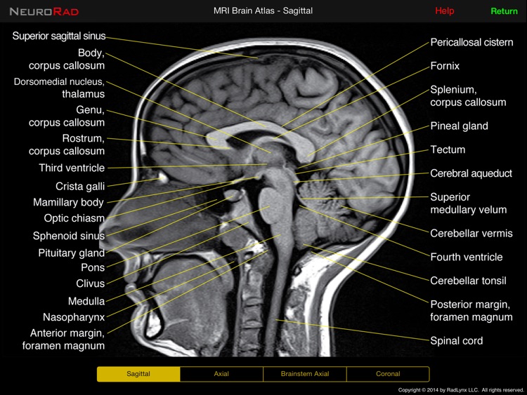 NeuroRad