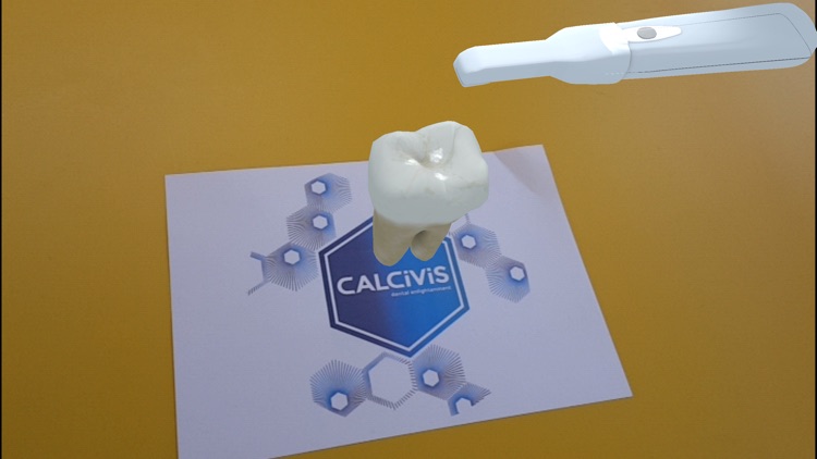 CALCIVIS imaging system