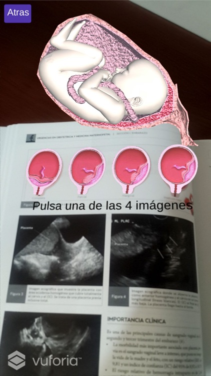 Urgencias en Obstetricia y Medicina Maternofetal screenshot-4