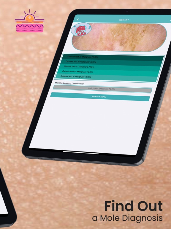 Mole Checker Skin Dermatology screenshot 2