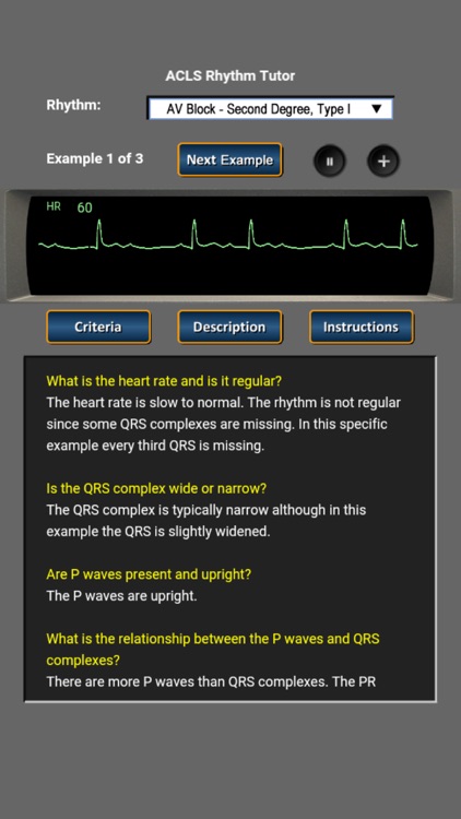 ACLS Rhythm Tutor