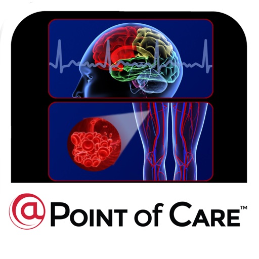 Stroke Prevention in Afib @Point of Care™