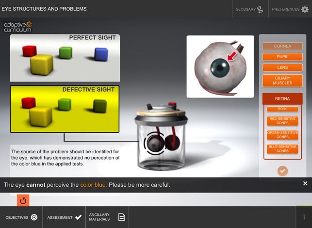 Eye Structures and Problems(圖2)-速報App