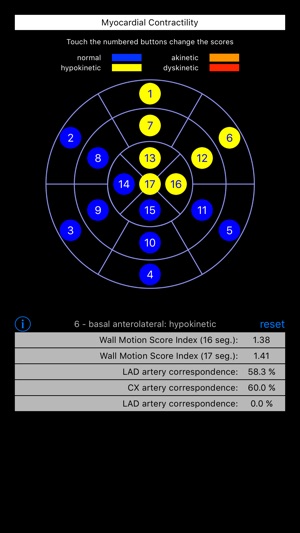 Wall Motion Score Index(圖3)-速報App