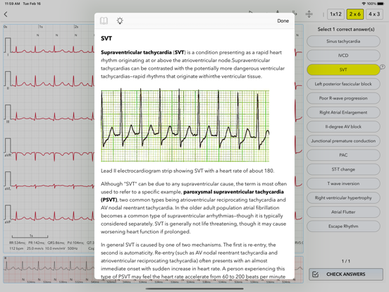 ECG Test Pro for Doctors screenshot 4