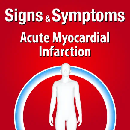 Signs & Symptoms Acute Myocardial Infarction Читы