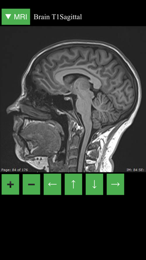 MRI Viewer(圖2)-速報App