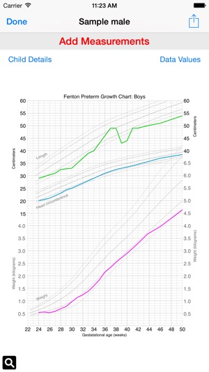 Preterm Growth Tracker Professional