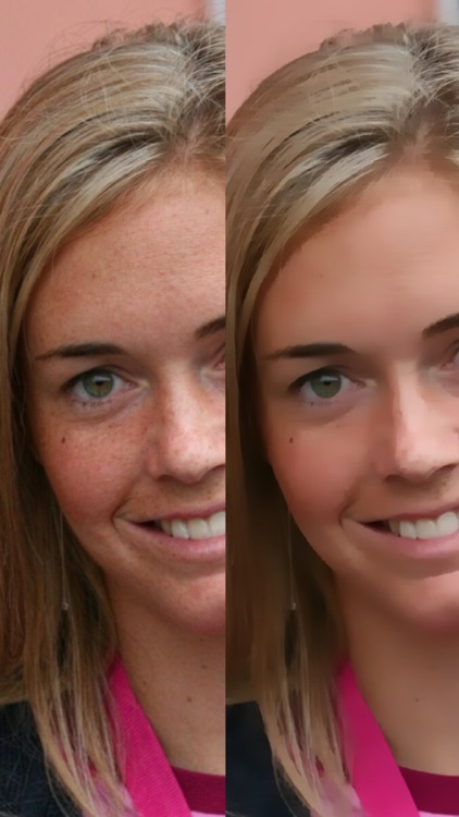 Look Younger - Perform Plastic Surgery on Photos