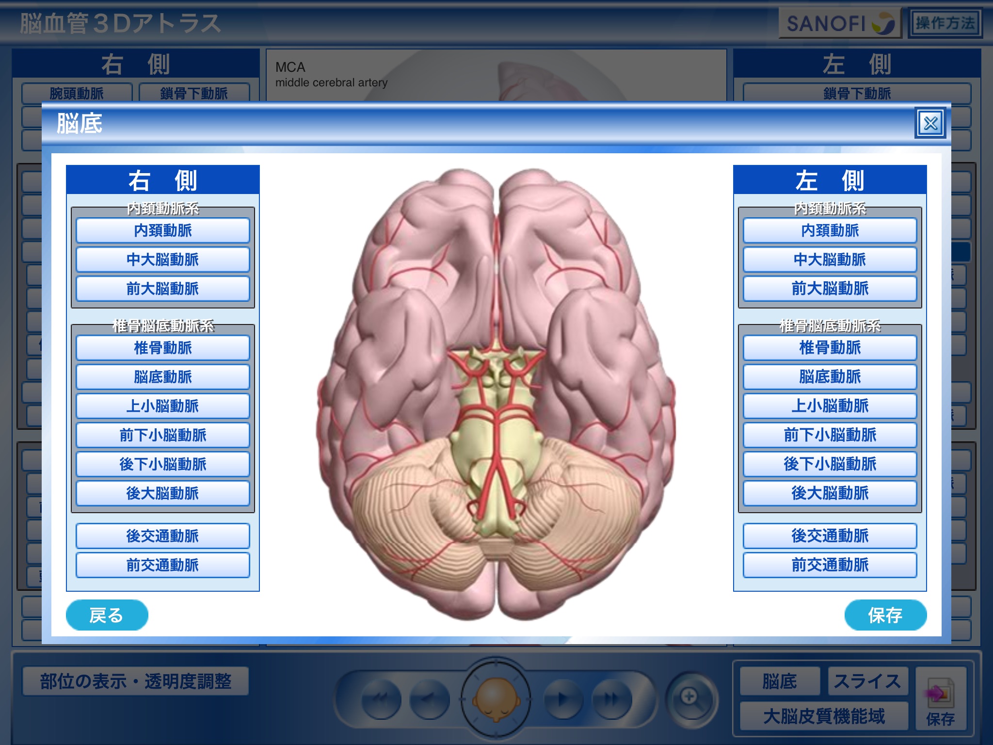 脳血管3Dアトラス　 screenshot 4