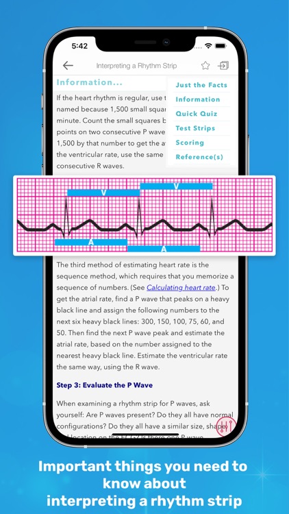 ECG Interpretation MIE screenshot-3