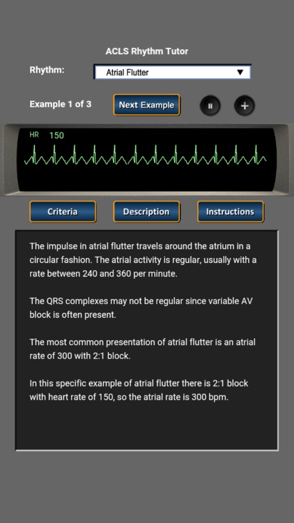 ACLS Rhythm Tutor