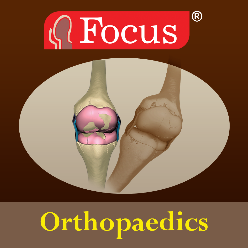 Get Orthopaedics - Understanding Disease for iOS, iPhone, iPad Aso Report