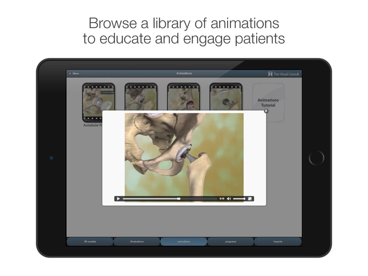 The Visual Consult: Hip Replacement screenshot-3