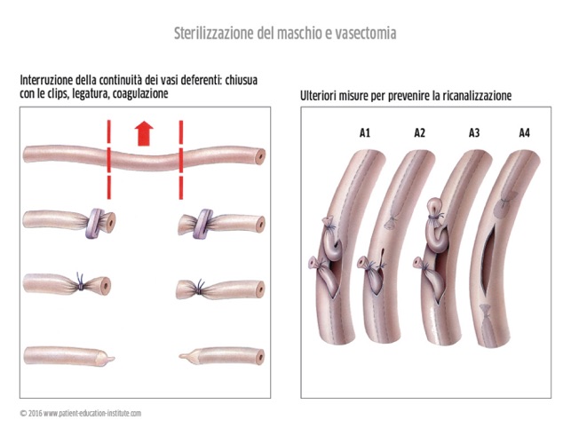 SIU, Urologia, tablet app(圖5)-速報App