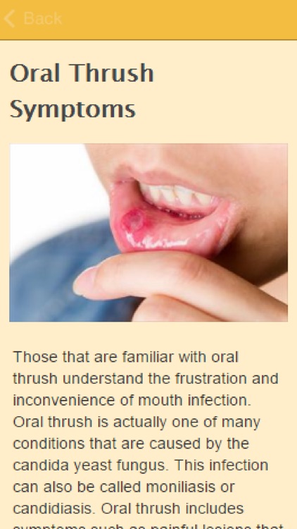 Symptoms Of Thrush