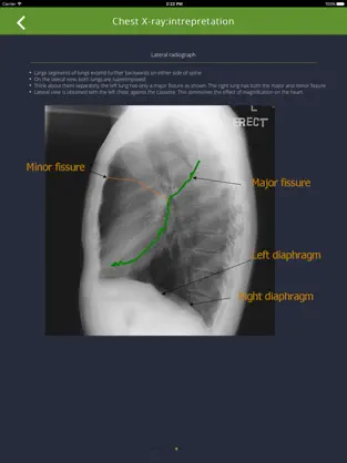 Imágen 4 Chest Radiographs iphone