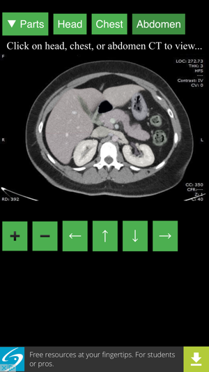 Anatomy on Radiology CT(圖2)-速報App