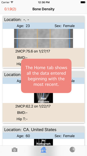 BoneGauge(圖4)-速報App