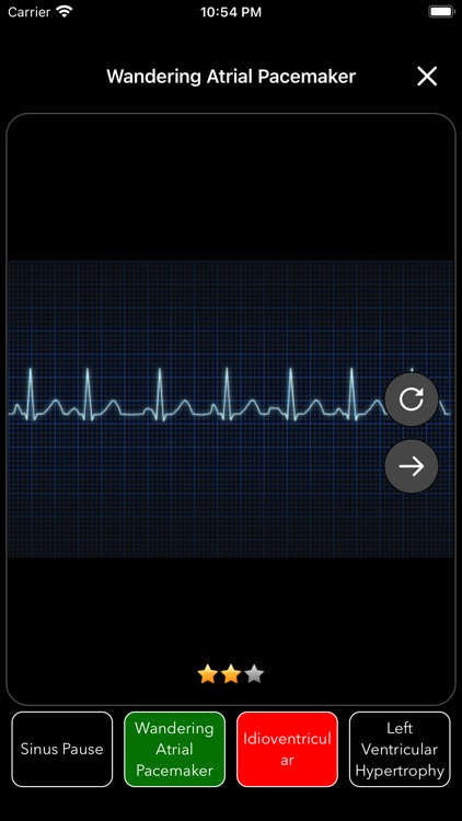 ECG Test for Doctors