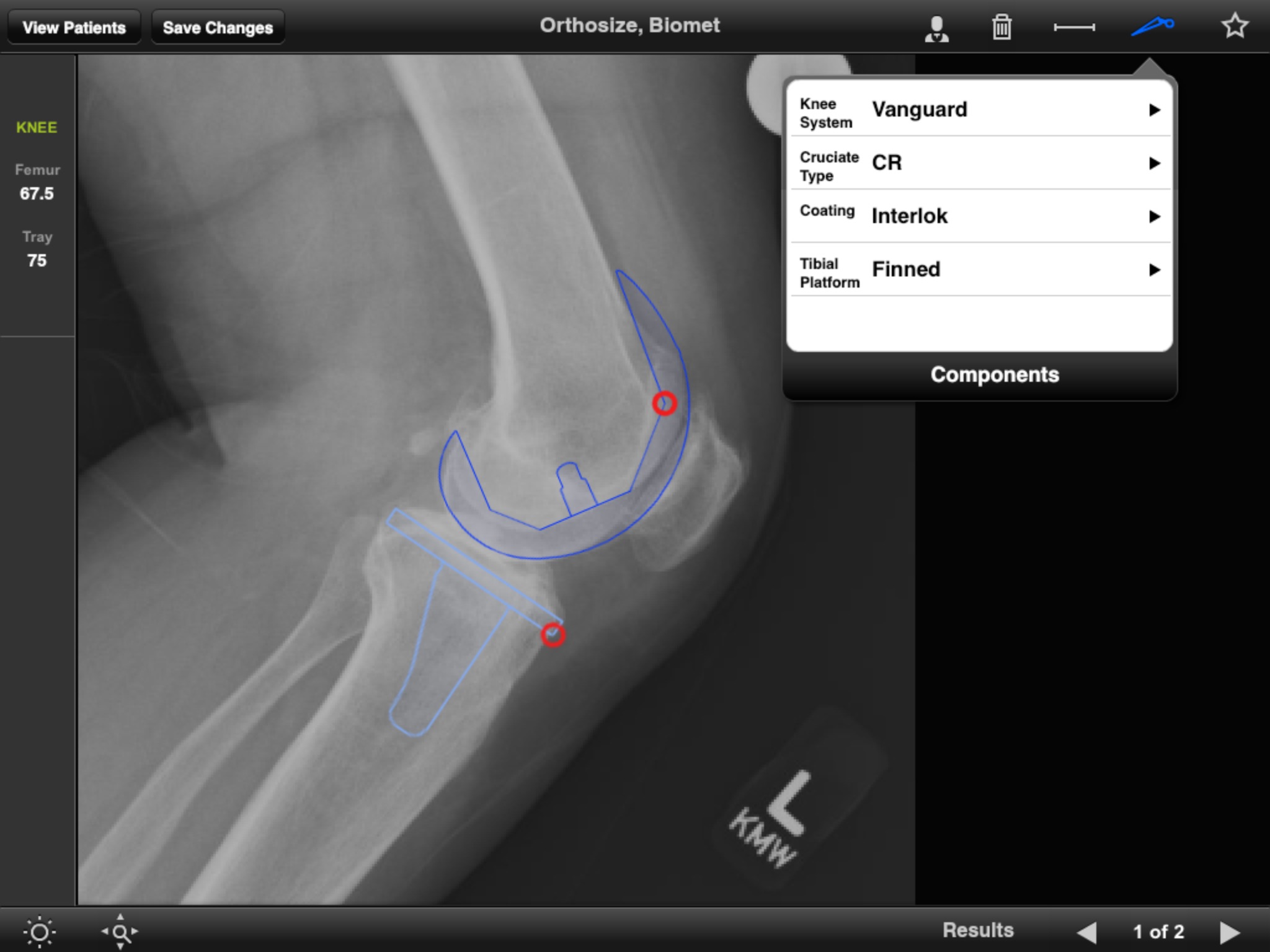 Biomet Orthosize Templating screenshot 3