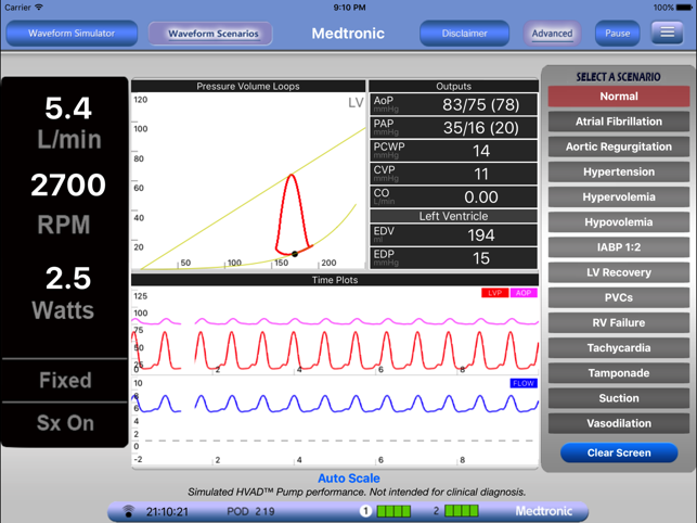 HVAD Waveforms(圖5)-速報App