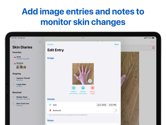 Screenshot #5 pour Derm Diary: Skin Tracker