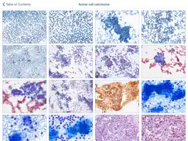 Game screenshot Johns Hopkins Atlas of Pancreatic Cytopathology apk