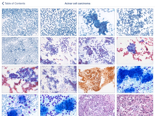 Johns Hopkins Atlas of Pancreatic Cytopathology(圖2)-速報App