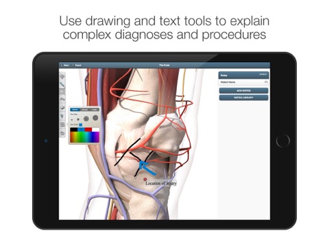 The Visual Consult: Knee Replacement screenshot 2